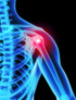 Chiropractic shoulder pain